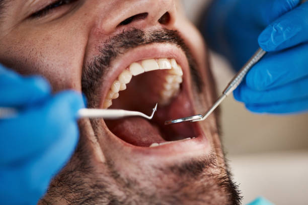 Best Emergency Cosmetic Dentistry in Rutgers University Livingston Campus, NJ