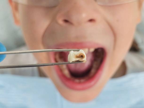 Best Emergency Dental Services for Seniors in Rutgers University Livingston Campus, NJ