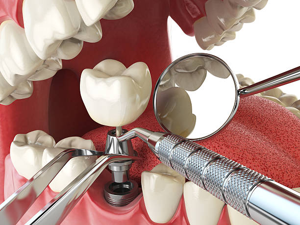 Best Mobile Emergency Dentist in Rutgers University Livingston Campus, NJ